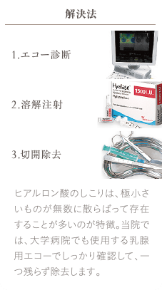 1.エコー診断 | 2.溶解注射 | 3.切開除去 | ヒアルロン酸のしこりは、極小さいものが無数に散らばって存在することが多いのが特徴。当院では、大学病院でも使用する乳腺用エコーでしっかり確認して、一つ残らず除去します。