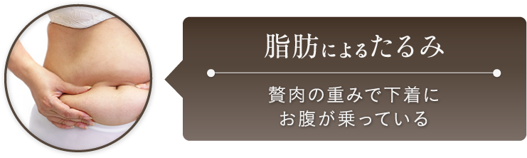 脂肪によるたるみ:贅肉の重みで下着にお腹が乗っている